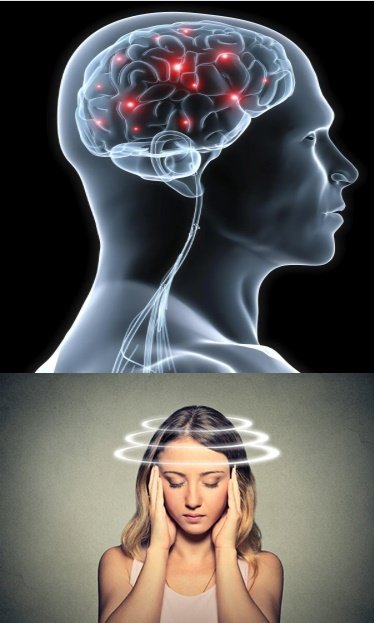 CogniClear Supplement